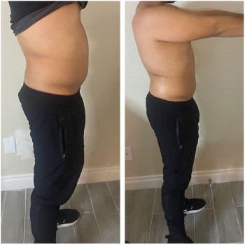 Активна програма корекції фігури (кавітація+вакуумний масаж+рф-ліфтинг)
                    Косметологический центр WE Cosmetology Киев