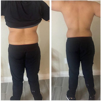 Активна програма корекції фігури (кавітація+вакуумний масаж+рф-ліфтинг)
                    Косметологический центр WE Cosmetology Киев