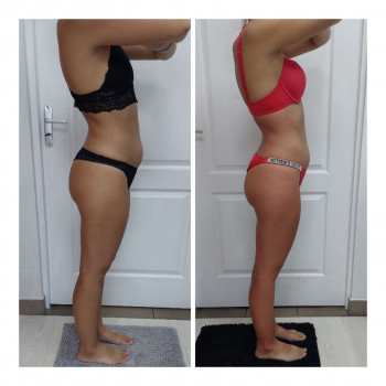 LPG Body Aesthetics, Бровари Фото - 24