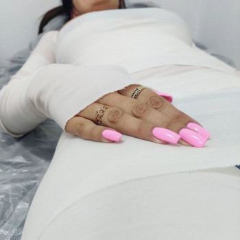 LPG Body Aesthetics, Бровари Фото - 41