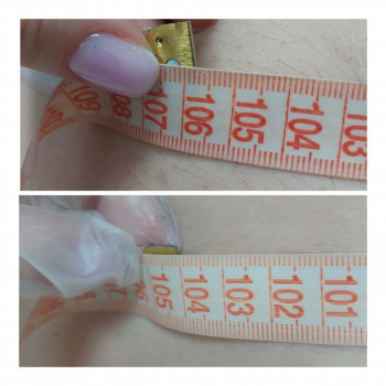 LPG Body Aesthetics, Бровари Фото - 69