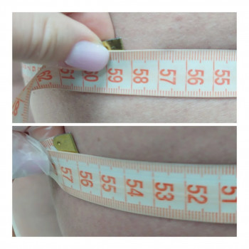 LPG Body Aesthetics, Бровари Фото - 70