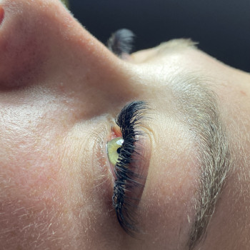 Нарощування війок