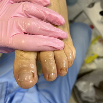 Фото из портфолио специалиста Татьяна Вакула (подолог, Харьков)