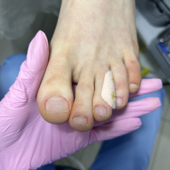 Фото из портфолио специалиста Татьяна Вакула (подолог, Харьков)