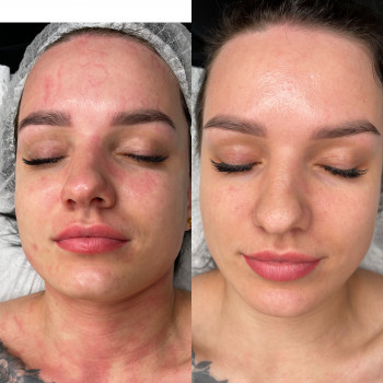 Лілія Смірнова, Ровно Фото - 10