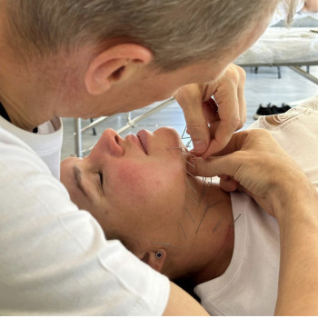 Face Lifting Acupuncture (голки)
                    Масажист Николай Київ