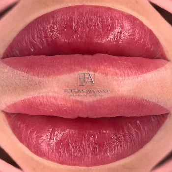 Анна Петровська, Буча Фото - 23