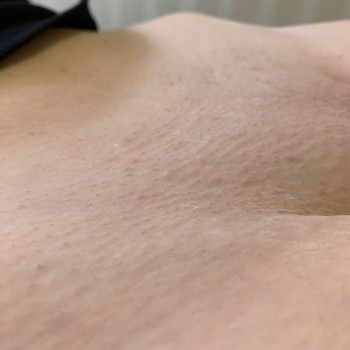 J-BLENS, Суми Фото - 34