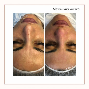 Анастасія Зайчикова, Черкаси Фото - 9