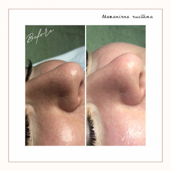 Анастасія Зайчикова, Черкаси Фото - 11