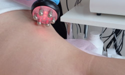 Рф-ліфтинг Косметологічний центр WE Cosmetology Полтава