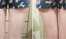 Обгортання "Лід та полум'я" Косметологічний центр WE Cosmetology Полтава