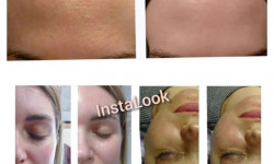 Мультифункціональний пілінг "Інста лук" Косметологічний центр WE Cosmetology Полтава