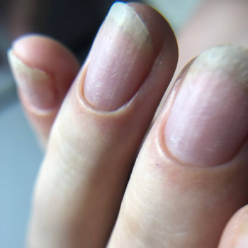 Богдана Бузалова, Лозовая Фото - 11