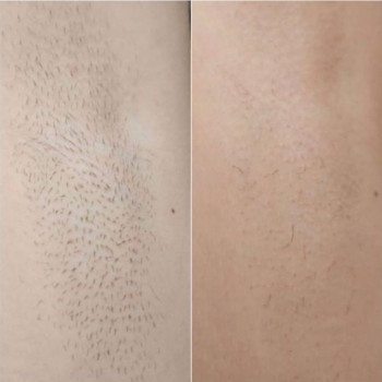 Laser Impuls, Киев Фото - 7