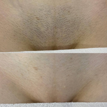 Laser Impuls, Киев Фото - 13