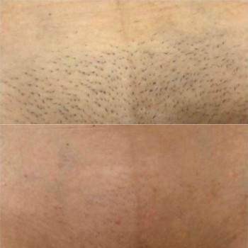 Laser Impuls, Киев Фото - 8