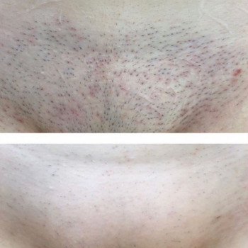 Laser Impuls, Киев Фото - 14