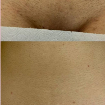 Laser Impuls, Киев Фото - 15