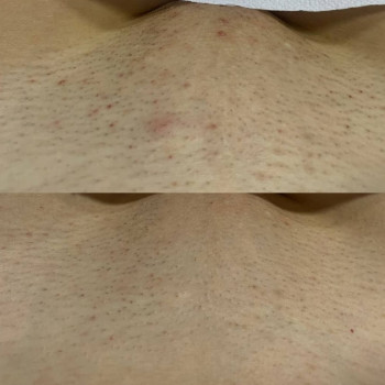 Laser Impuls, Киев Фото - 16