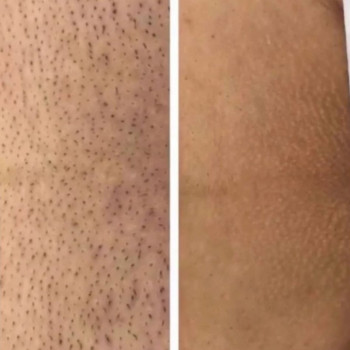 Laser Impuls, Киев Фото - 19