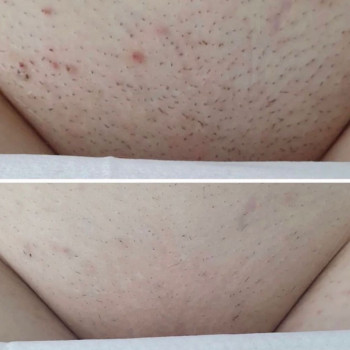 Laser Impuls, Киев Фото - 21