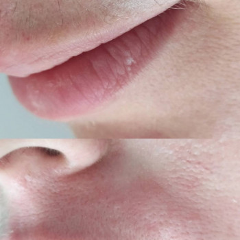 Laser Impuls, Киев Фото - 20