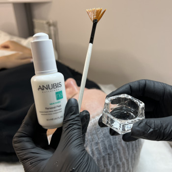 Оновлюючий пілінг