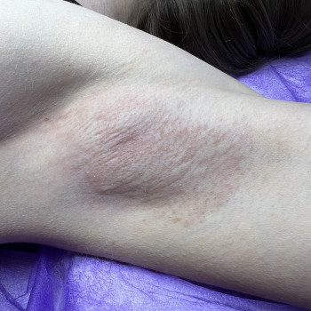 Тетяна Лісанова, Запоріжжя Фото - 6