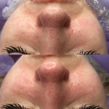 Догляд за обличчям
                    Косметолог Мария Полтава