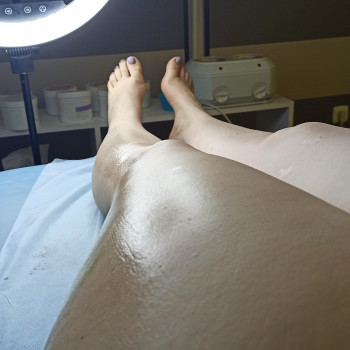 Шугаринг та Воскова депіляція
                    Майстер депіляції Анна Львів