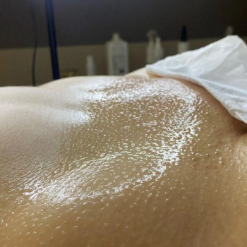 Шугаринг та Воскова депіляція
                    Майстер депіляції Анна Львів