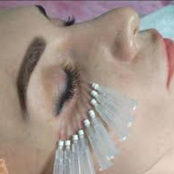 Укріплення периорбітальної зони