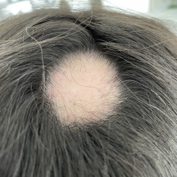 Христина Чорній, Тернополь Фото - 17