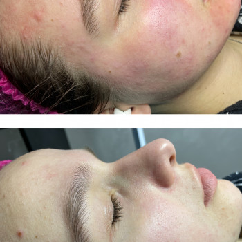 Христина Чорній, Тернополь Фото - 21