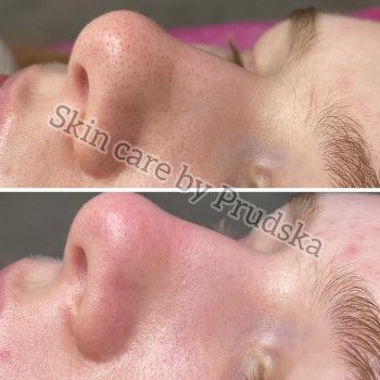 Вера Прудская, Бровары Фото - 22