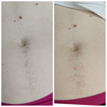 Ксения Кириленко, Одесса Фото - 4