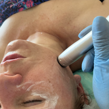 RF-ліфтинг безопноаційне омолодження