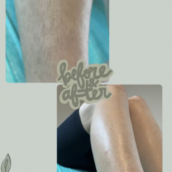 Алла Панечко, Луцк Фото - 22