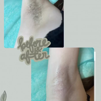 Алла Панечко, Луцк Фото - 23