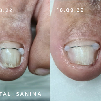 Наталия Санина, Киев Фото - 73