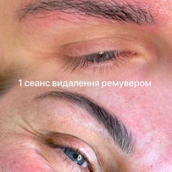 Тату удаление старого перманента ремувером, фото - Салон краси Cocoon