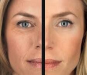 Пілінг Джеснера Косметолог-инъекционист Людмила Киев