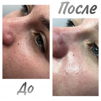 Анастасія Мельникова, Черкаси Фото - 7