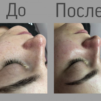 Анастасія Мельникова, Черкаси Фото - 9