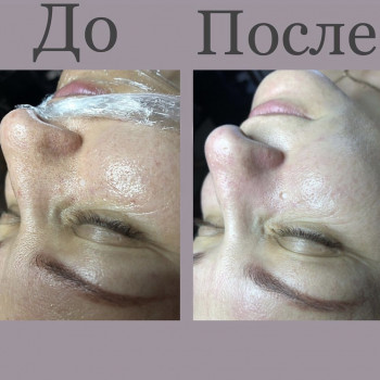 Анастасія Мельникова, Черкаси Фото - 10