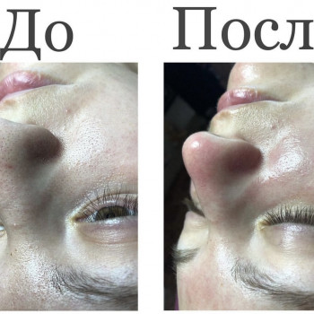 Анастасія Мельникова, Черкаси Фото - 11