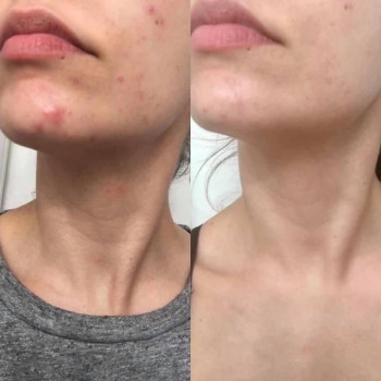 Досконала, Киев Фото - 15