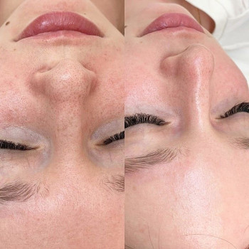 Досконала, Киев Фото - 17